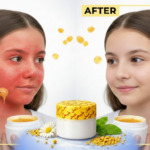 كريم العسل الملكي الأصلي بتركيبة غذاء ملكات النحل لترميم البشرة وعلاج الفروة